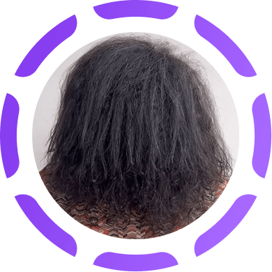 Cabelo ressecado
